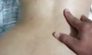 مقعد prolapse بیوی،  ...