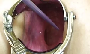 ایلمر کی بیوی سے میر ...
