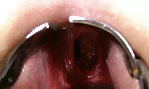 ڈبل مقعد مٹھی، prola ...