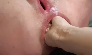گدا مقعد میکسیکن slu ...